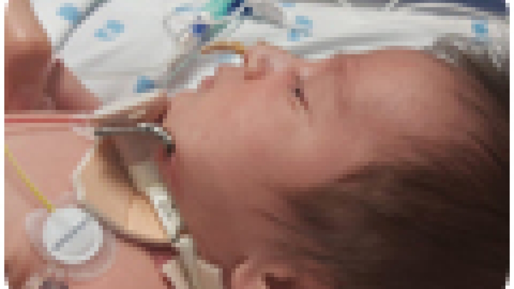 Bebé recupera esperança de vida após cirurgia em Gaia